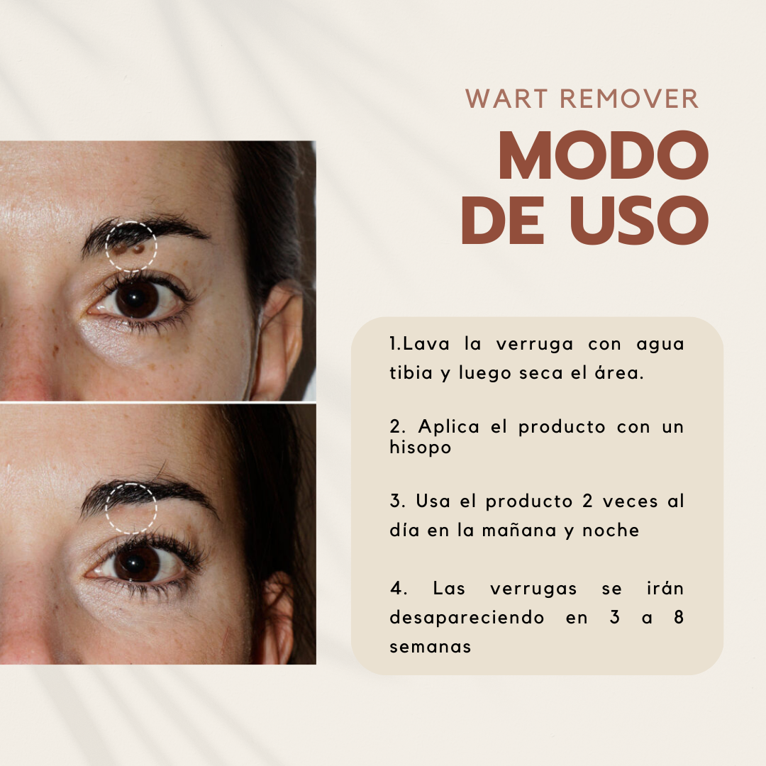 Wart Remover - Elimina las verrugas en 2 semanas