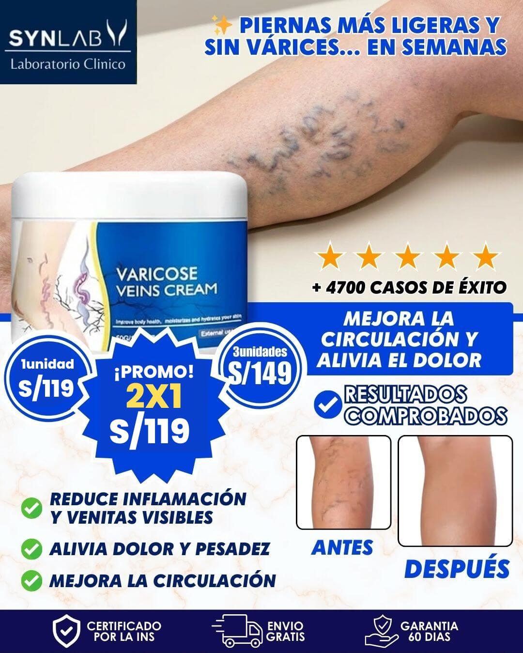 Spray Anti-Varices 100% Natural